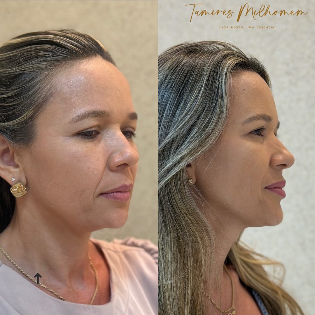 Full Face